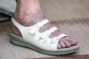 A photo of a seniors food in a white sandal